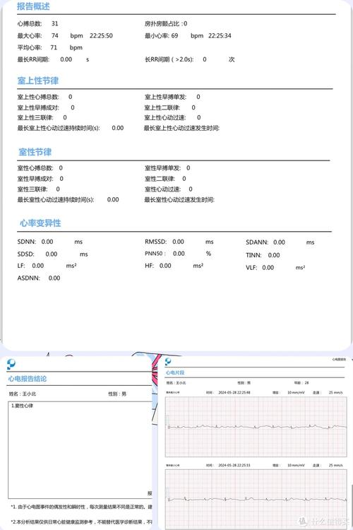 血氧仪上面两个数值是代表什么的？血氧仪的读数怎么看（最新）-第6张图片-创耀新闻网