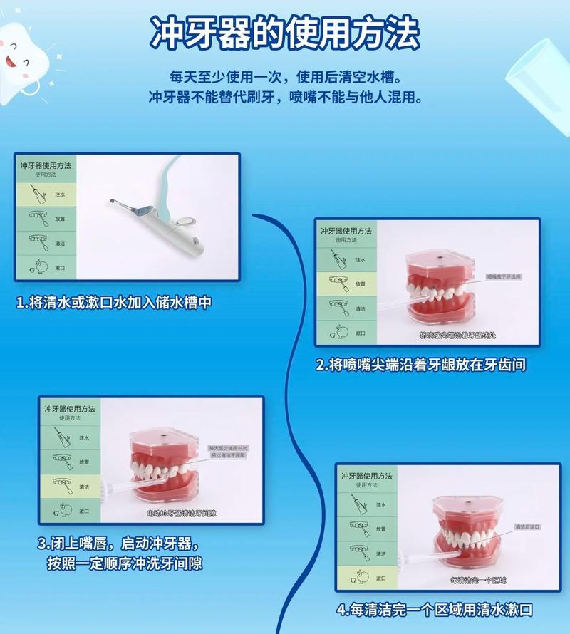 刷牙了还需要冲牙器吗？刷牙了还需要用漱口水吗（最新）-第4张图片-创耀新闻网