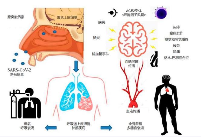 疫情的影响世界？疫情的世界影响和应对措施（最新）-第5张图片-创耀新闻网